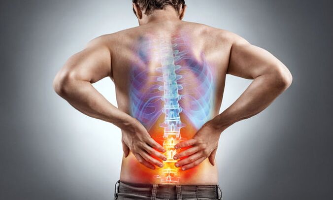 cause of back pain