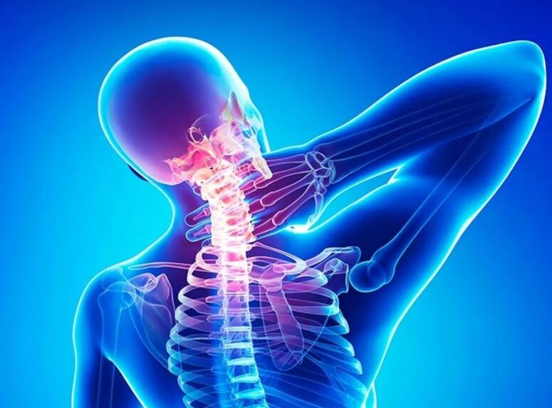 Cervical spine osteochondrosis