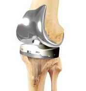 Prosthetics together