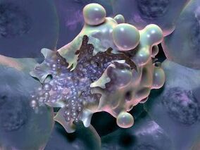 The death of a cell