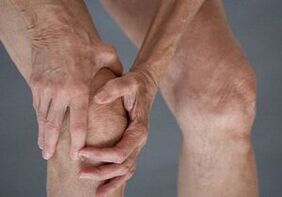 How is manifest arthrosis of the knee joint