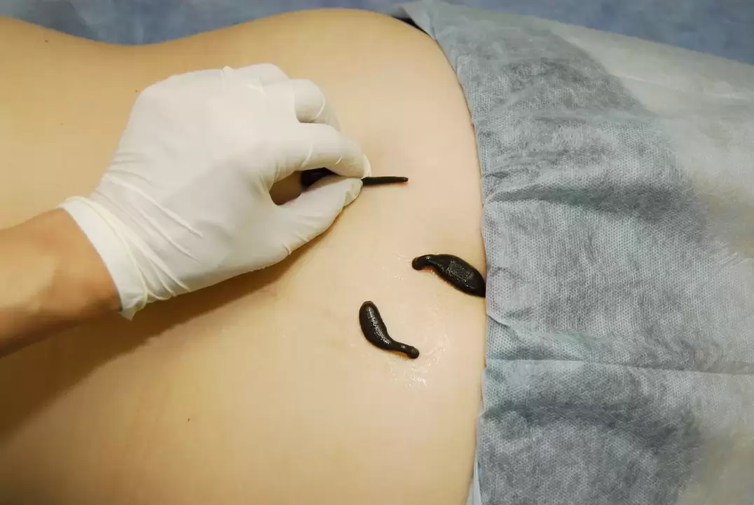 leech placement for lumbar osteochondrosis