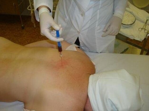 Injection treatment